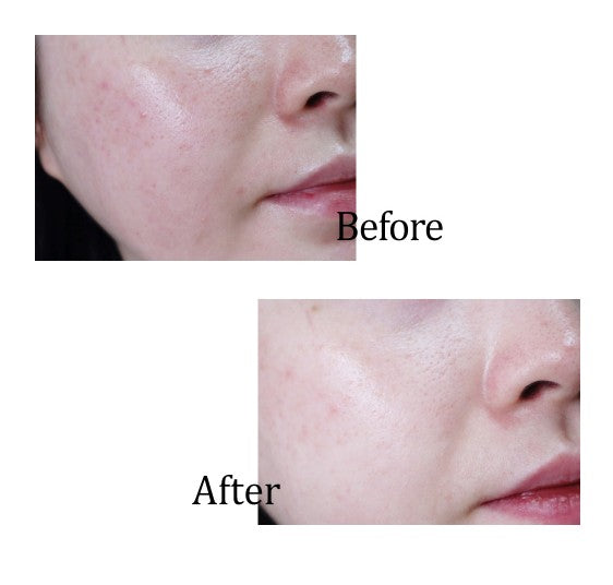 Aperire Spa relief very pretty pore mask 120G